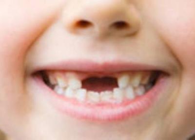 چگونه از دندان بچه ها مراقبت کنیم؟